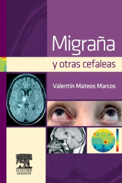 E-kniha Migrana y otras cefaleas Valentin Mateos Marcos
