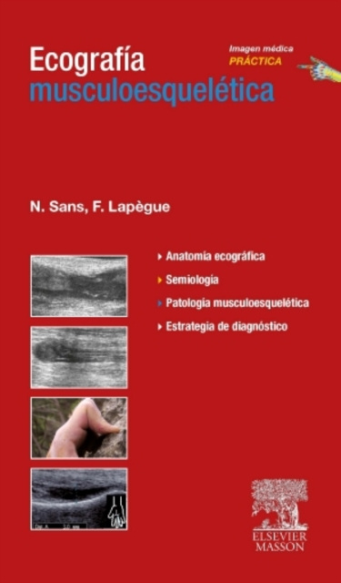 E-kniha Ecografia musculoesqueletica Nicolas Sans