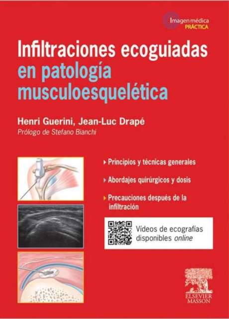 E-kniha Infiltraciones ecoguiadas en patologia musculoesqueletica Henri Guerini