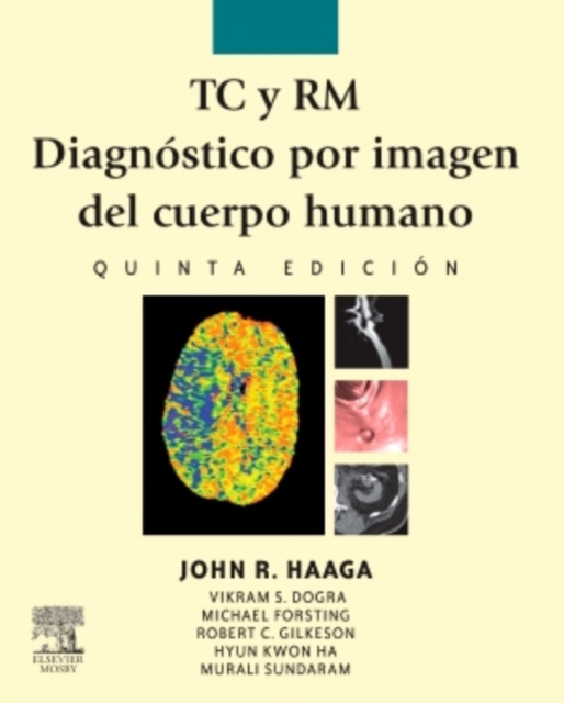 E-kniha TC y RM. Diagnostico por imagen del cuerpo humano John R. Haaga