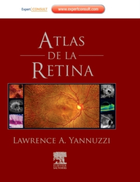 E-kniha Atlas de la retina Lawrence A. Yannuzzi
