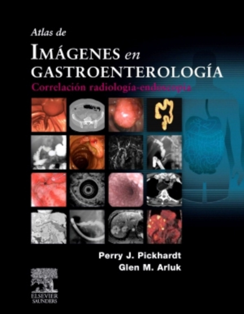 E-kniha Atlas de imagenes en gastroenterologia Perry J. PICKHARDT