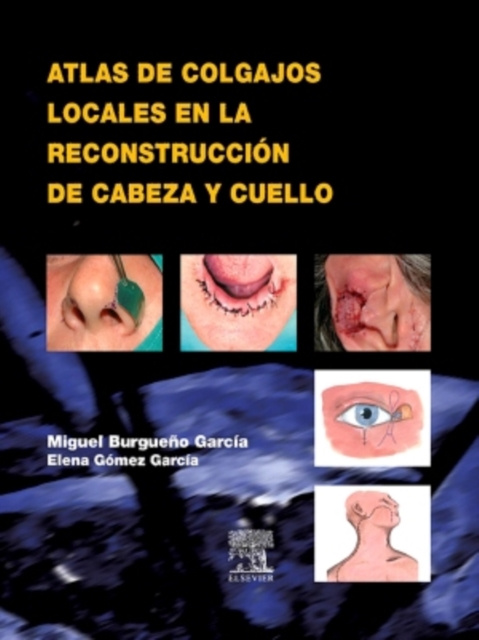 E-kniha Atlas de colgajos locales en la reconstruccion de cabeza y cuello Miguel Burgueno Garcia