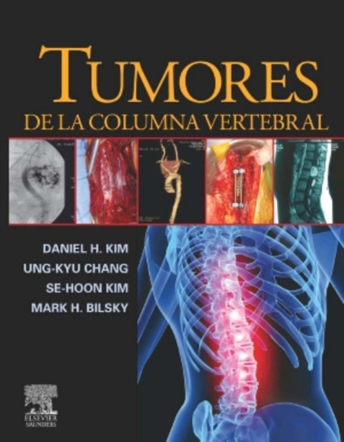 E-kniha Tumores de la columna vertebral Daniel H. Kim