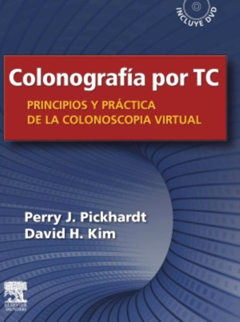 E-kniha Colonografia por TC: Principios y practica de la colonoscopia virtual Perry J. Pickhardt