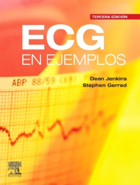 E-kniha ECG en ejemplos Dean Jenkins