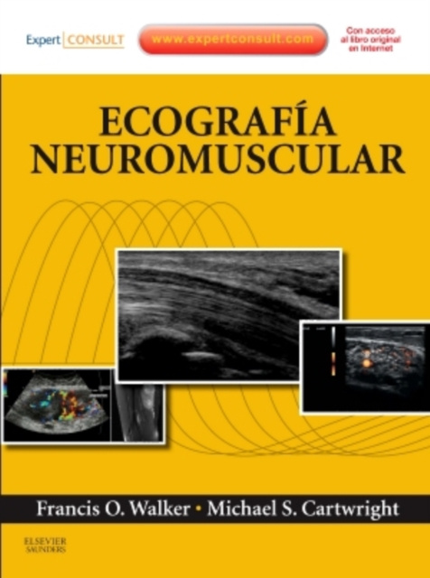 E-book Ecografia neuromuscular Francis MD Walker