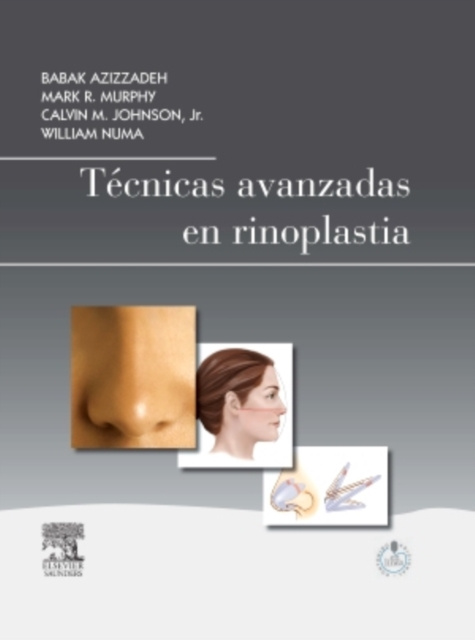 E-kniha Tecnicas avanzadas en rinoplastia Babak Azizzadeh