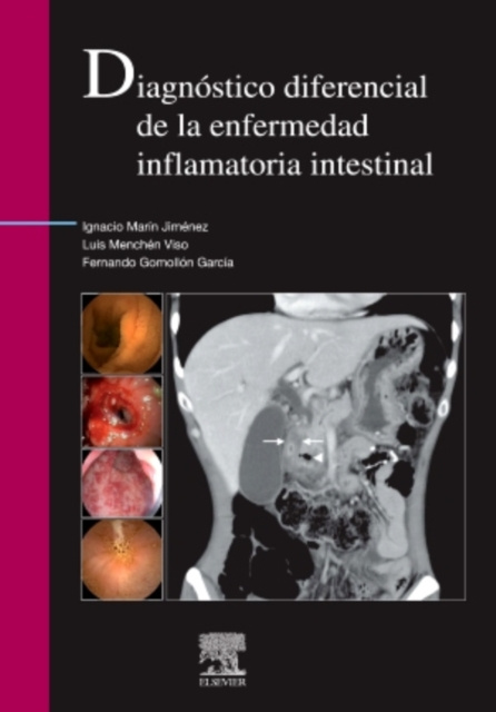 E-kniha Diagnostico diferencial de la enfermedad inflamatoria intestinal Ignacio Marin-Jimenez