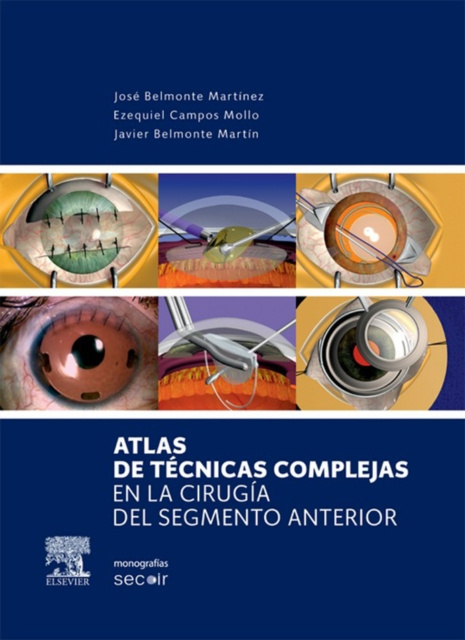 E-kniha Atlas de tecnicas complejas en la cirugia del segmento anterior Jose Belmonte Martinez