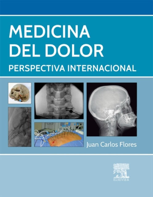 E-kniha Medicina del dolor Juan Carlos Flores