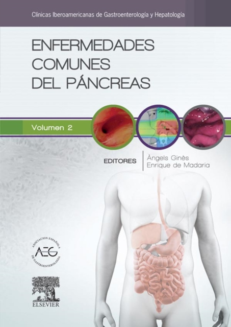 E-kniha Enfermedades comunes del pancreas Angels Gines Gibert