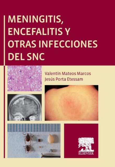 E-kniha Meningitis, encefalitis y otras infecciones del SNC Valentin Mateos Marcos