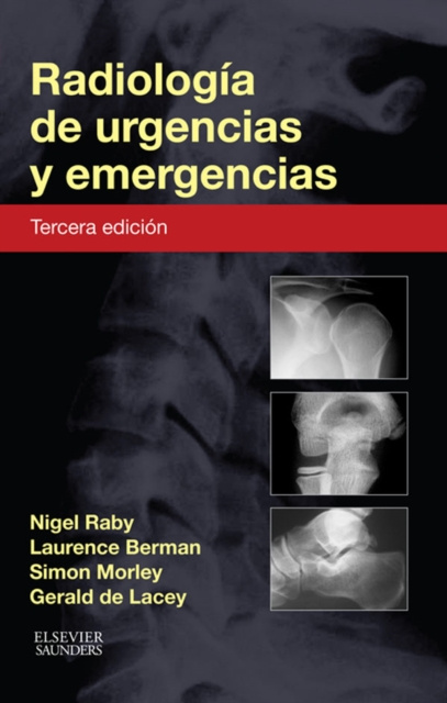 E-kniha Radiologia de urgencias y emergencias Nigel Raby