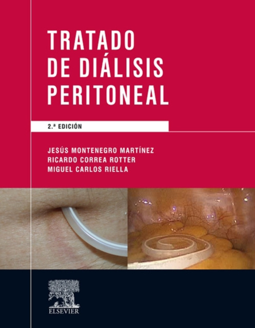 E-kniha Tratado de dialisis peritoneal Jesus Montenegro Martinez