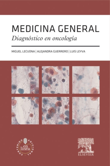 E-kniha Medicina general. Diagnostico en oncologia Miguel Lecuona Rodriguez