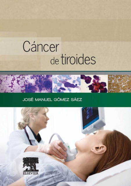 E-kniha Cancer de tiroides Jose Manuel Gomez Saez