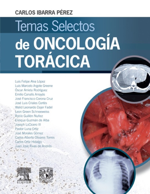 E-kniha Temas selectos de oncologia toracica Carlos Ibarra Perez