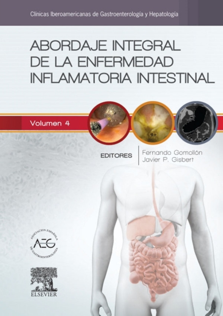 E-kniha Abordaje integral de la enfermedad inflamatoria intestinal Fernando Gomollon Garcia