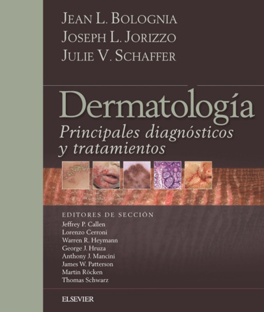 E-kniha Bolognia. Dermatologia: Principales diagnosticos y tratamientos Jean L. Bolognia