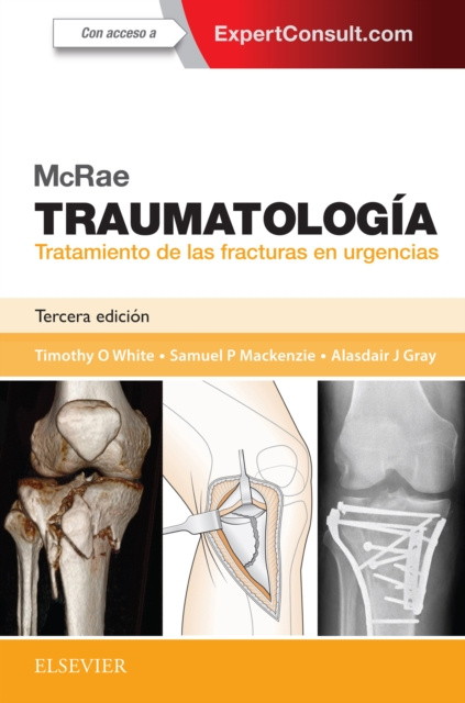 E-kniha McRae. Traumatologia. Tratamiento de las fracturas en urgencias Timothy O White