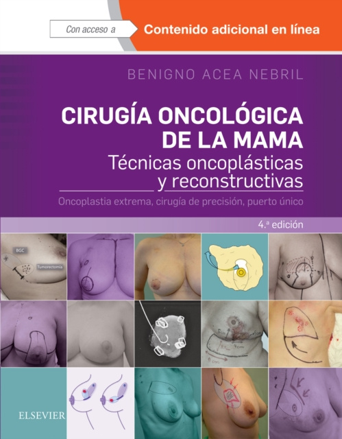 E-kniha Cirugia oncologica de la mama Benigno Acea Nebril