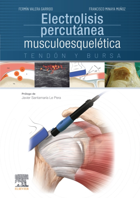 E-kniha Electrolisis percutanea musculoesqueletica Fermin Valera Garrido