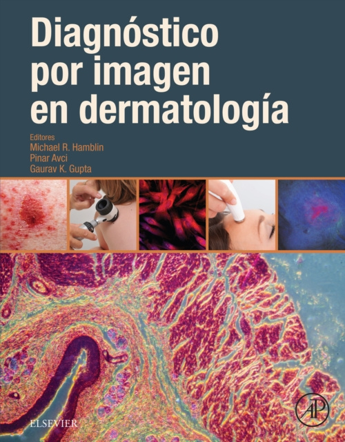 E-kniha Diagnostico por imagen en dermatologia Michael R. Hamblin