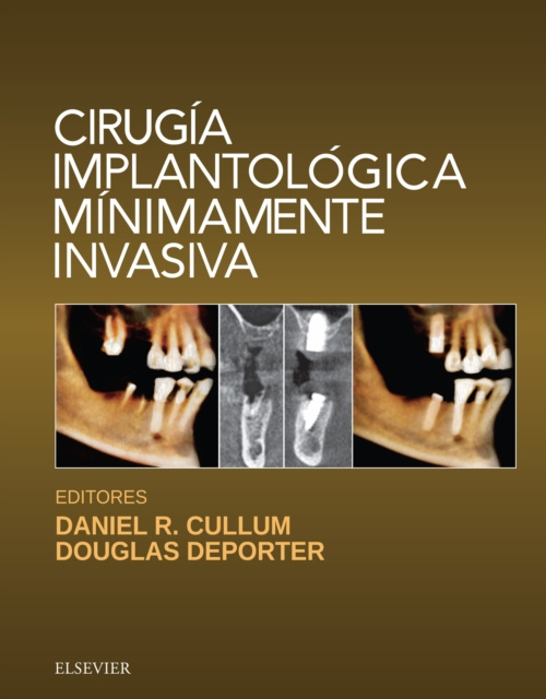 E-kniha Cirugia implantologica minimamente invasiva Daniel R. Cullum
