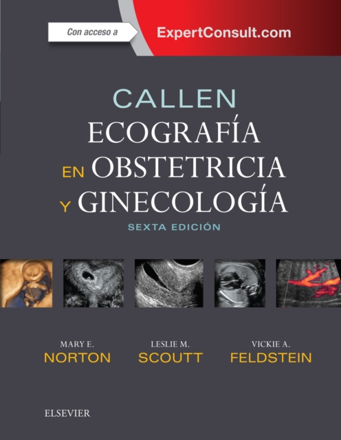 E-kniha Callen. Ecografia en obstetricia y ginecologia Peter W. Callen