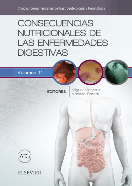 E-kniha Consecuencias nutricionales de las enfermedades digestivas Miguel Montoro Huguet