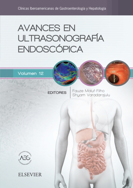 E-kniha Avances en ultrasonografia endoscopica Fauze Maluf