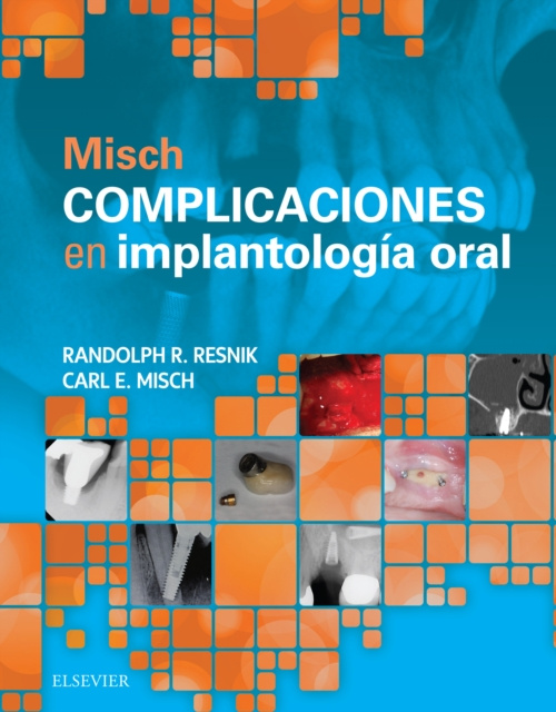 E-kniha Misch. Complicaciones en implantologia oral Randolph Resnik