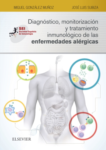E-kniha Diagnostico, monitorizacion y tratamiento inmunologico de las enfermedades alergicas Miguel Gonzalez Munoz