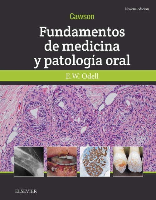 E-kniha Cawson.Fundamentos de medicina y patologia oral Roderick A. Cawson