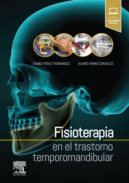 E-book Fisioterapia en el trastorno temporomandibular Tomas Perez Fernandez