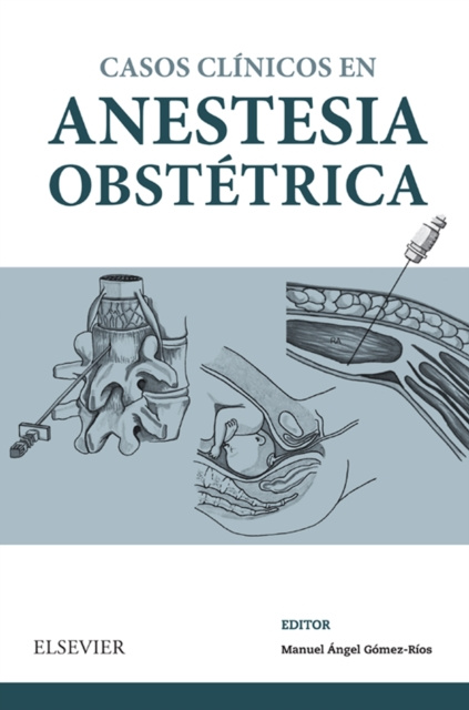 E-kniha Casos Clinicos en anestesia obstetrica Manuel Gomez Rios