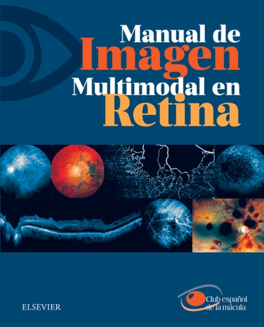 E-kniha Manual de imagen multimodal en retina Club espanol de la macula