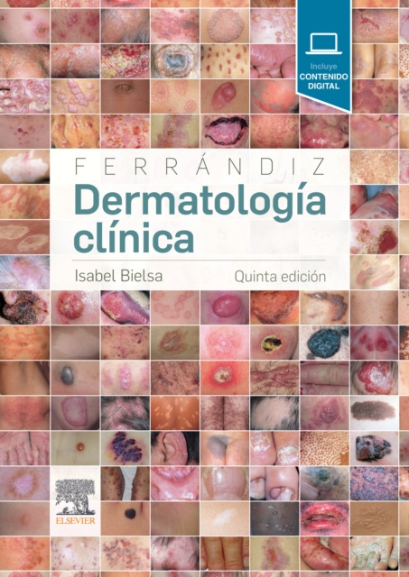 E-kniha Ferrandiz. Dermatologia clinica Isabel Bielsa Marsol