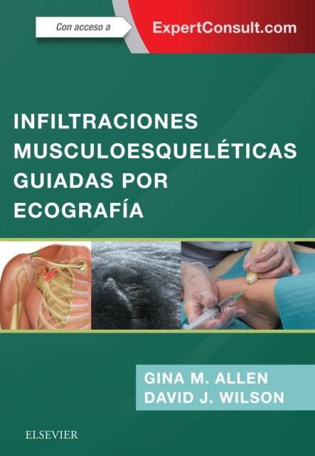 E-book Infiltraciones musculoesqueleticas guiadas por ecografia Gina M Allen