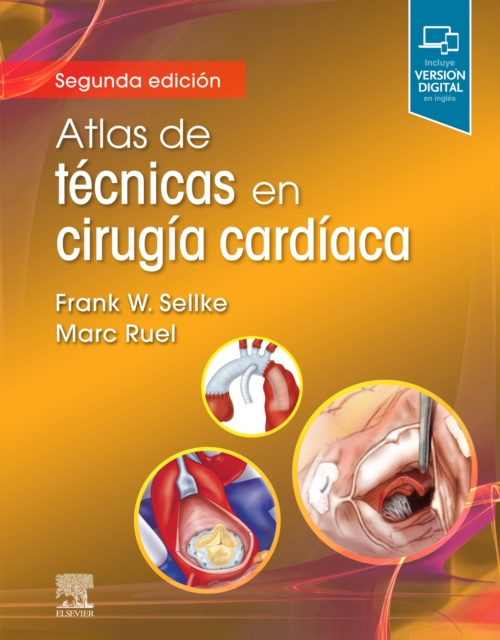 E-book Atlas de tecnicas en cirugia cardiaca Frank Sellke