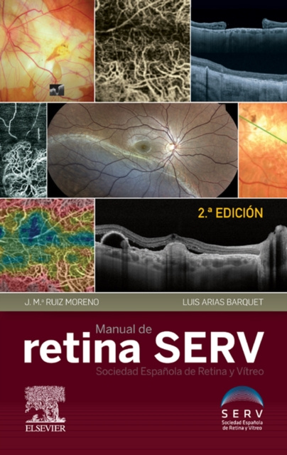 E-kniha Manual de retina SERV Jose Maria Ruiz Moreno