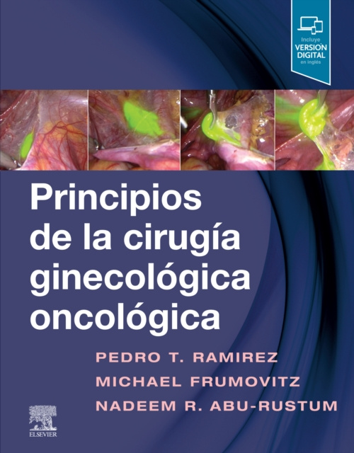 E-kniha Principios de la cirugia ginecologica oncologica Pedro T. Ramirez