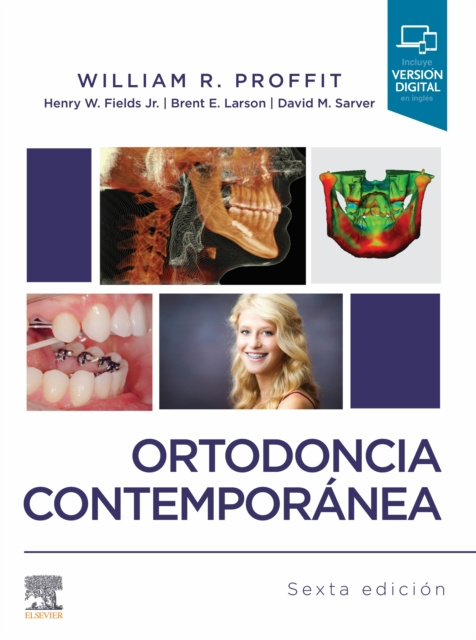 ebook Ortodoncia contemporanea William R. Proffit