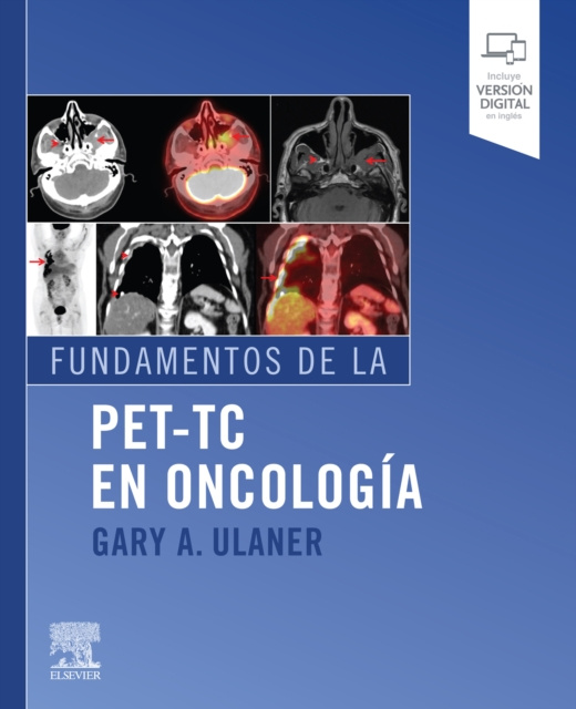 E-kniha Fundamentos de la PET-TC en oncologia Gary Ulaner