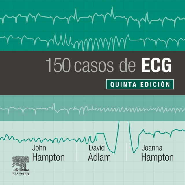E-kniha 150 casos de ECG John Hampton