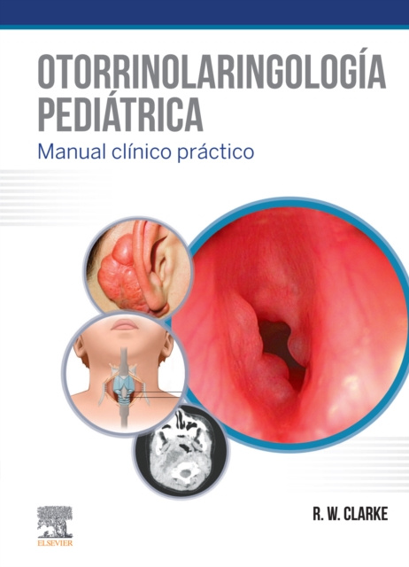 E-kniha Otorrinolaringologia pediatrica Ray W Clark
