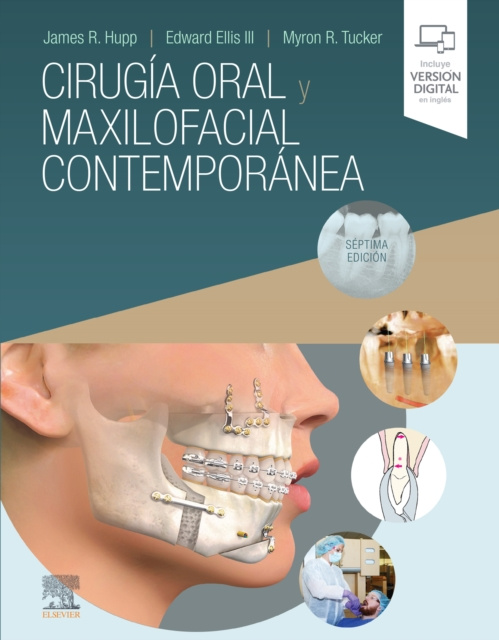 E-kniha Cirugia oral y maxilofacial contemporanea James R. Hupp