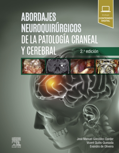 E-kniha Abordajes neuroquirurgicos de la patologia craneal y cerebral Jose Manuel Gonzalez Darder