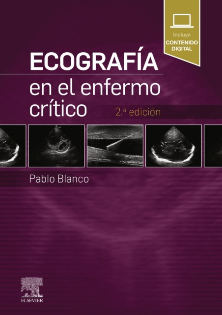 E-kniha Ecografia en el enfermo critico Pablo Blanco